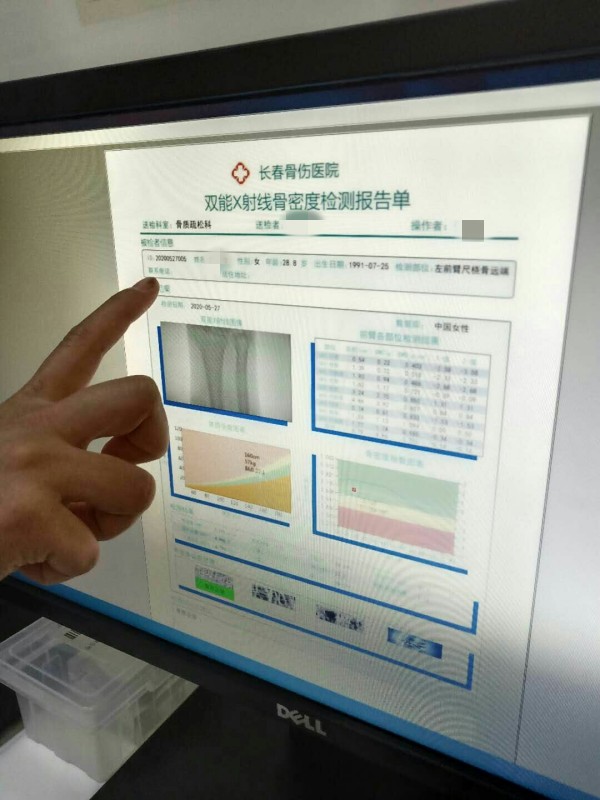 品源雙能X射線骨密度儀落戶吉林省長春骨傷醫(yī)院，助力骨松診療