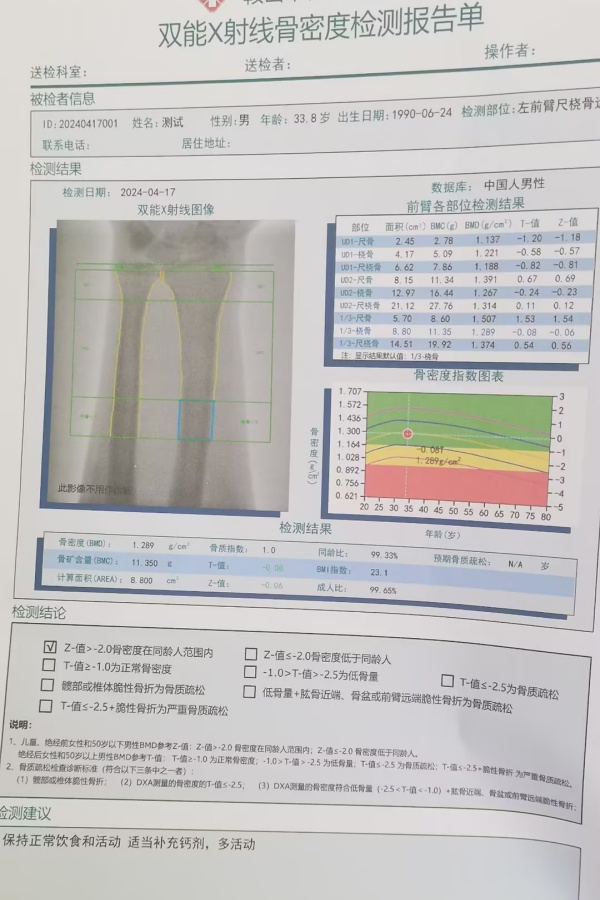 雙能X射線骨密度儀：準(zhǔn)確測量骨密度，助力骨質(zhì)疏松防治，守護(hù)骨骼健康